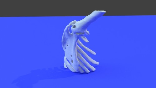 Right Shoulder Joint 3D Printable STL File Converted From CT Scan ...