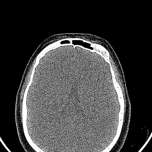 HEAD EXAMPLE MUSCLES Skull, Head, and Neck CTs