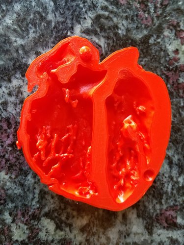 3d-printable-human-heart-model-improved-with-stackable-slices-stl