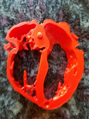 3d-printable-human-heart-model-improved-with-stackable-slices-stl