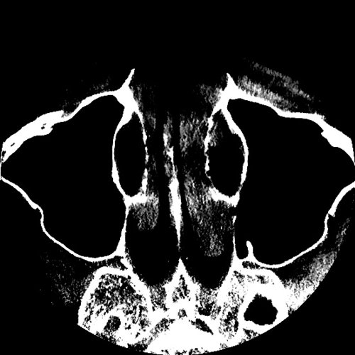 tejaswini ramesh - Dental, Orthodontic, Maxillofacial CTs - embodi3D.com