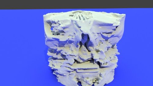 Scan Data - stl file processed - Dental, Orthodontic, Maxillofacial CTs ...