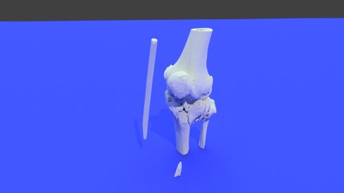 ss3 - stl file processed - Extremity, Lower (Leg) - embodi3D.com