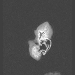 prueba fabi - MRIs - embodi3D.com