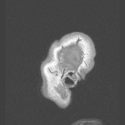 prueba fabi - MRIs - embodi3D.com