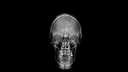scout test - Skull and Face - embodi3D.com
