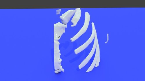 Breast cancer test_1 - stl file processed - Thorax and Ribs - embodi3D.com