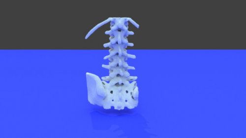 my back - stl file processed - Spine and Pelvis - embodi3D.com