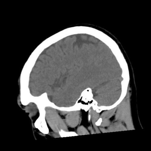 Brain test 2 - Skull, Head, and Neck CTs - embodi3D.com
