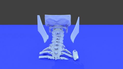 Neck scan - stl file processed - Spine and Pelvis - embodi3D.com