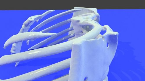 multifile1 - stl file processed - Thorax and Ribs - embodi3D.com