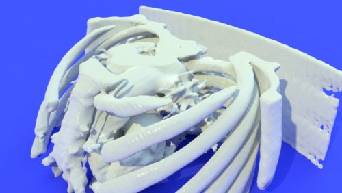 multifile1 - stl file processed - Thorax and Ribs - embodi3D.com
