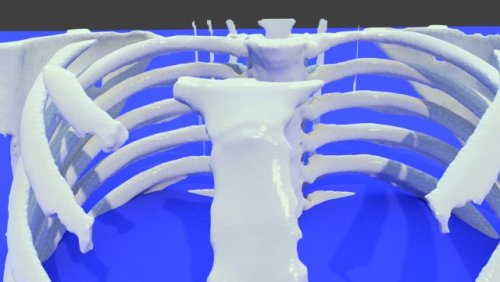 multifile1 - stl file processed - Thorax and Ribs - embodi3D.com