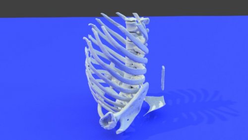 YC - stl file processed - Thorax and Ribs - embodi3D.com