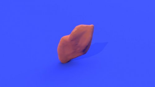 Irregular tumor - stl file processed - Muscular tumors and sarcomas ...
