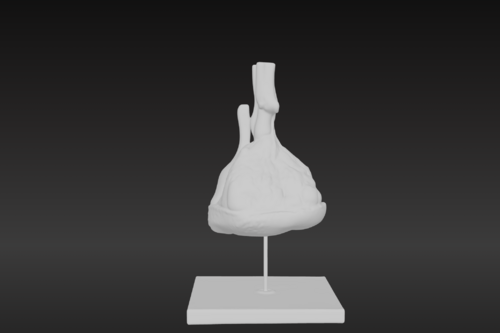 3D Model of Pulmonary Lobule - Lungs - embodi3D.com