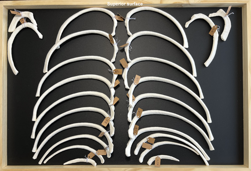 CT Ribs and Thoracic Vertebrae - Thorax and Ribs - embodi3D.com