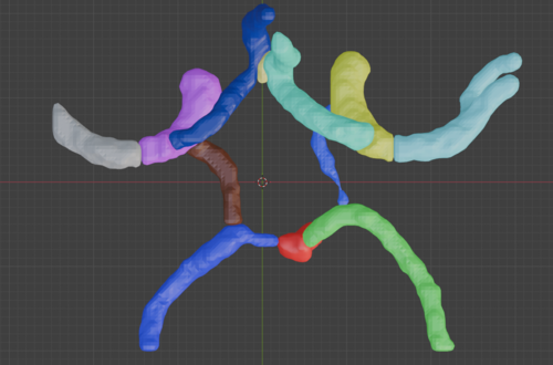 Circle of Willis – Cerebral Arteries 3D Printable Model (CTA ...