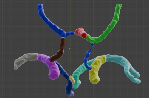 Circle of Willis – Cerebral Arteries 3D Printable Model (CTA ...
