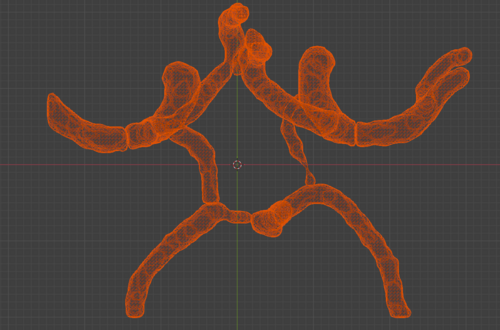 Circle of Willis – Cerebral Arteries 3D Printable Model (CTA ...