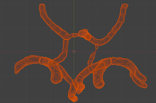 Circle of Willis – Cerebral Arteries 3D Printable Model (CTA ...