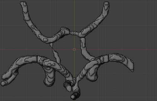 Circle of Willis – Cerebral Arteries 3D Printable Model (CTA ...