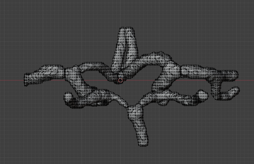 Circle of Willis – Cerebral Arteries 3D Printable Model (CTA ...
