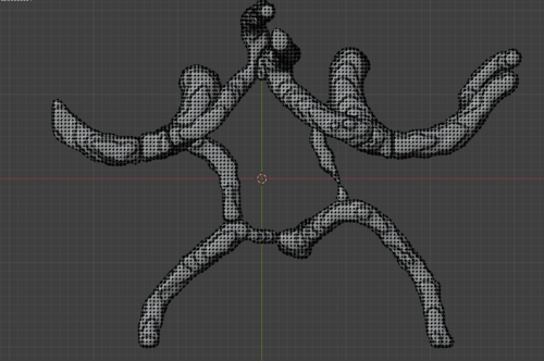 Circle of Willis – Cerebral Arteries 3D Printable Model (CTA ...