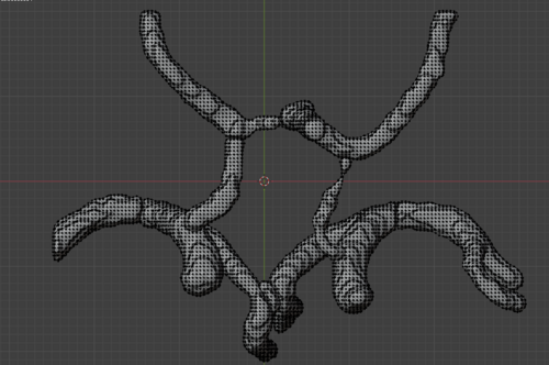 Circle of Willis – Cerebral Arteries 3D Printable Model (CTA ...