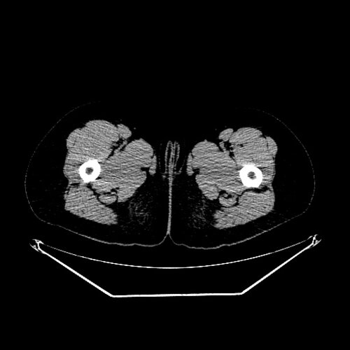 it is a ct scan file. it will be used for 3d printing - democratiz3D ...