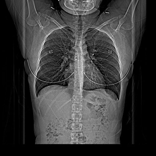 RIBS CT - democratiz3D® Processing - embodi3D.com