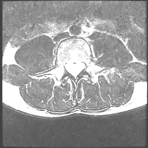 Lumbar2 - democratiz3D® Processing - embodi3D.com