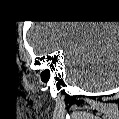 Poschl Derived Right ear - democratiz3D® Processing - embodi3D.com