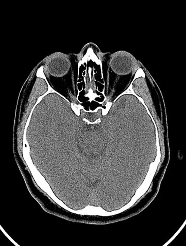 sinus - democratiz3D® Processing - embodi3D.com