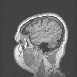 HEAD - MRIs - embodi3D.com