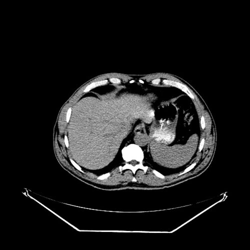 CT scan to body test - democratiz3D® Processing - embodi3D.com