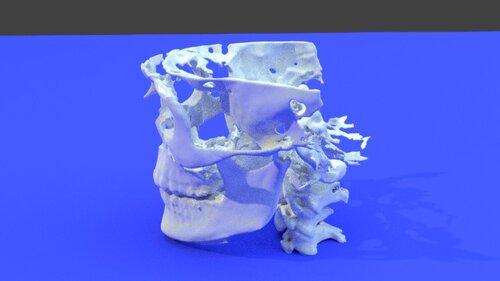 big man teeth 2 - stl file processed - Skull and Face - embodi3D.com