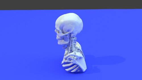 Neck CTV Bone and Vascular - stl file processed - Head and Neck ...